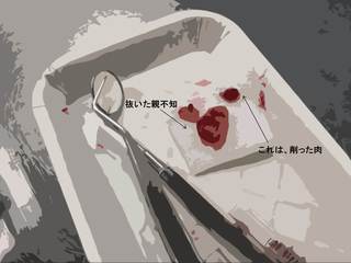 歯.jpg